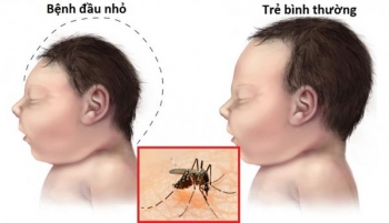 phu nu co thai can lam gi de phong chong zika