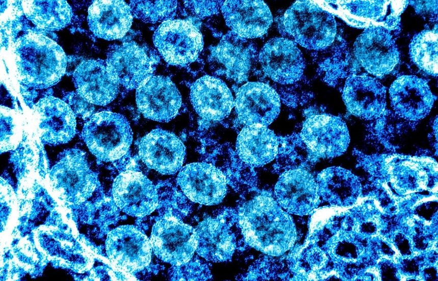 Virus SARS-CoV-2 thay đổi hình dạng để tăng khả năng sống sót