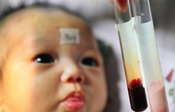  13 triệu người Việt mang gen bệnh Thalassemia